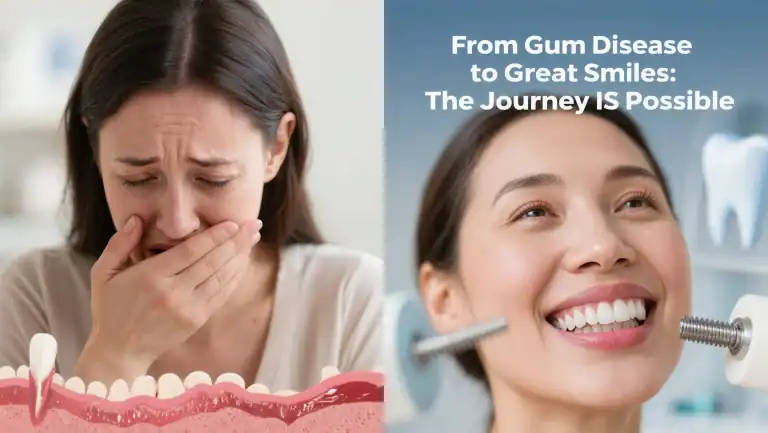 How Gum Disease Patients Get Successful Implants