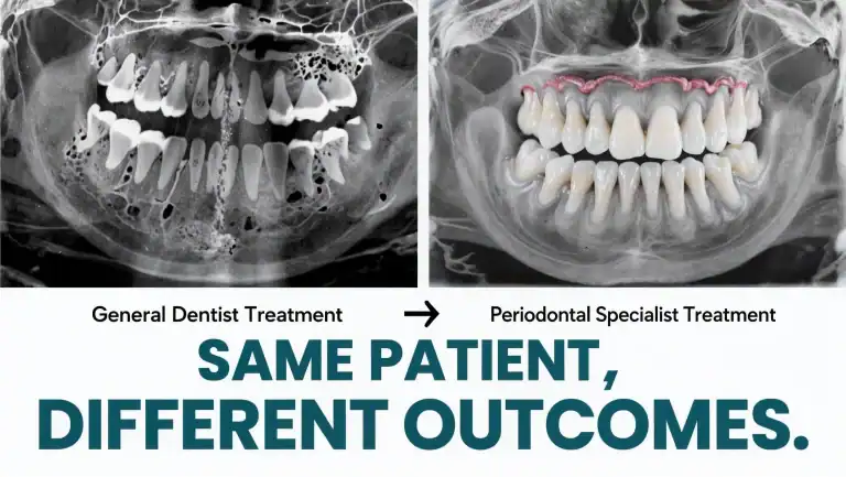 Insiders Edition: Gum Disease Experts