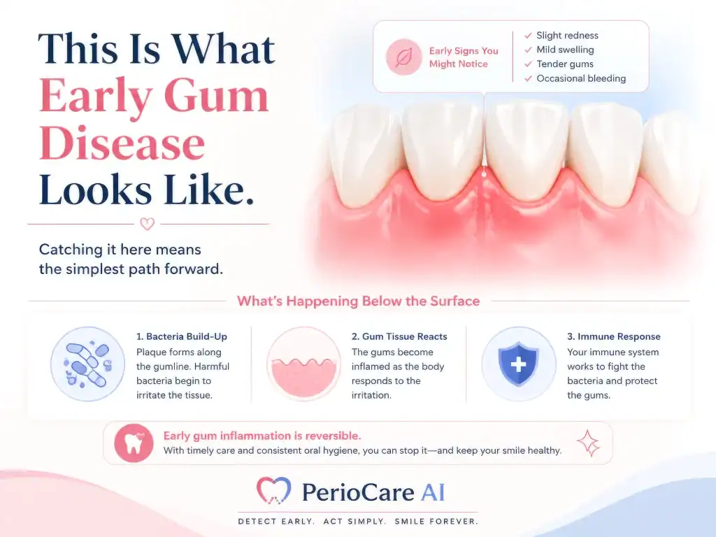 Inflammation of gums indicating early signs of periodontal disease and the importance of prompt dent.